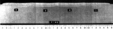 Figure 2: Macrostructure of Band-Overlay weld